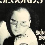 El texto musical RACISM SUCKS de 7 SECONDS también está presente en el álbum Skins, brains & guts (1982)