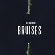 El texto musical LOST ON YOU de LEWIS CAPALDI también está presente en el álbum Bloom (2017)